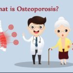 trend health, What is Osteoporosis?