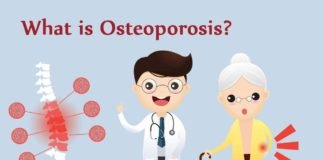 trend health, What is Osteoporosis?