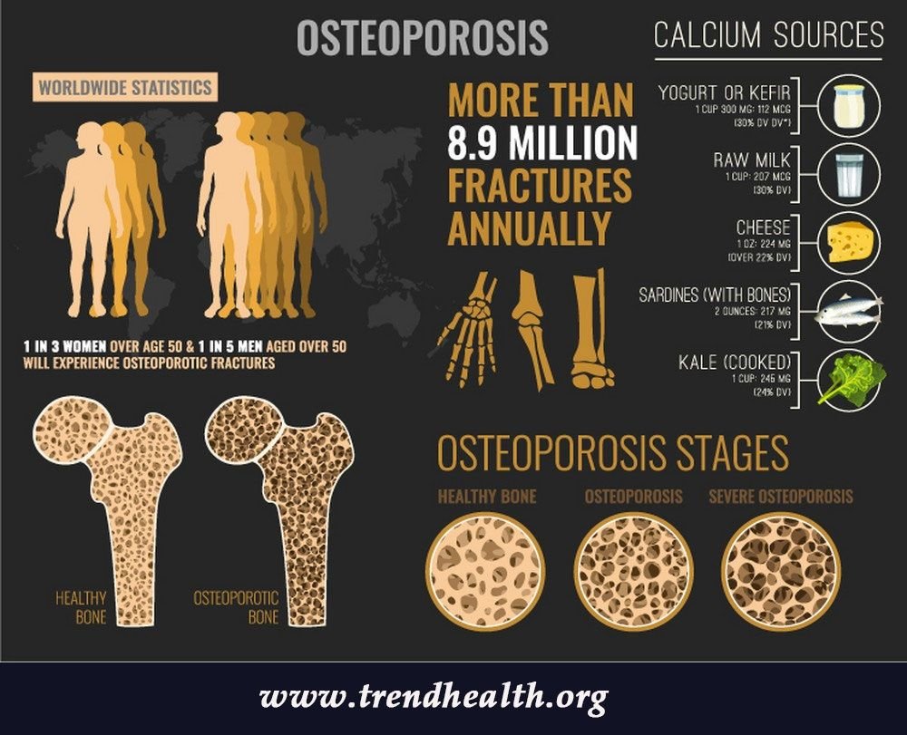 what is the treatment for osteoporosis, trend health