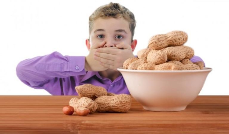 Peanut Allergy, trend health