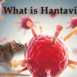 What is Hantavirus?, trend health