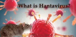 What is Hantavirus?, trend health