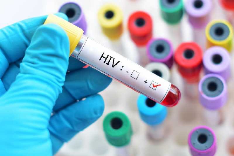 HIV Transmission Rates, Trend Health