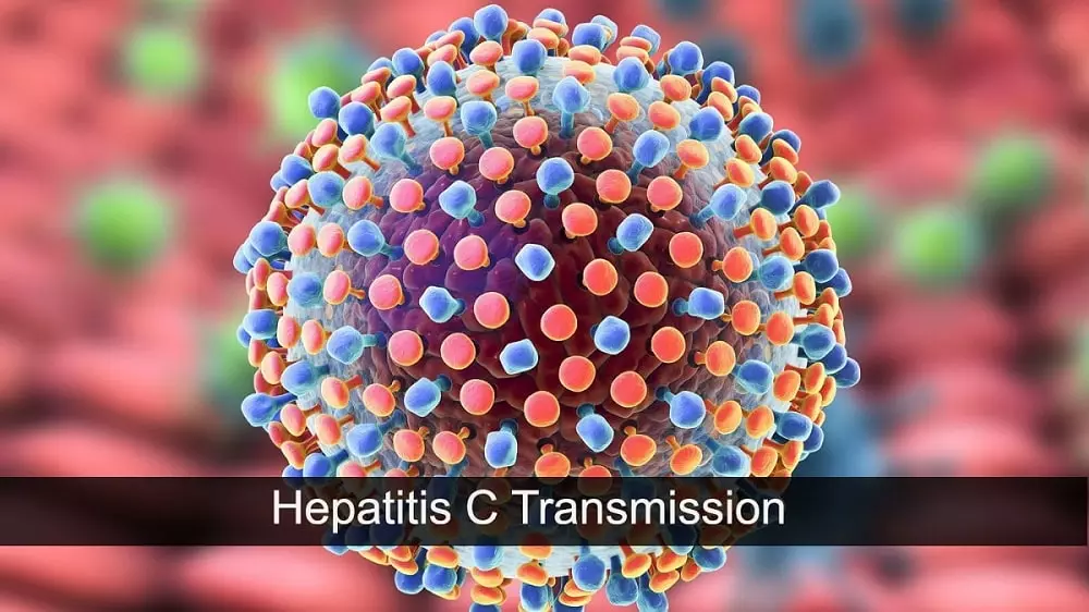 How is Hepatitis C transmitted? Is Hep C Curable? Is Hep C Curable?, Trend Health