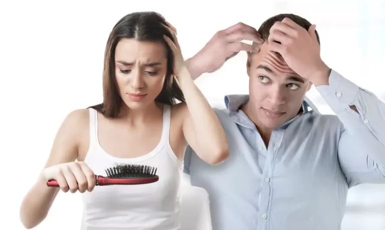 Hair Loss – Types of Alopecia & Causes of Thinning Hair