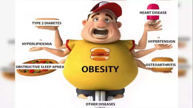 What is Obesity? Types, Causes and Risk Factors