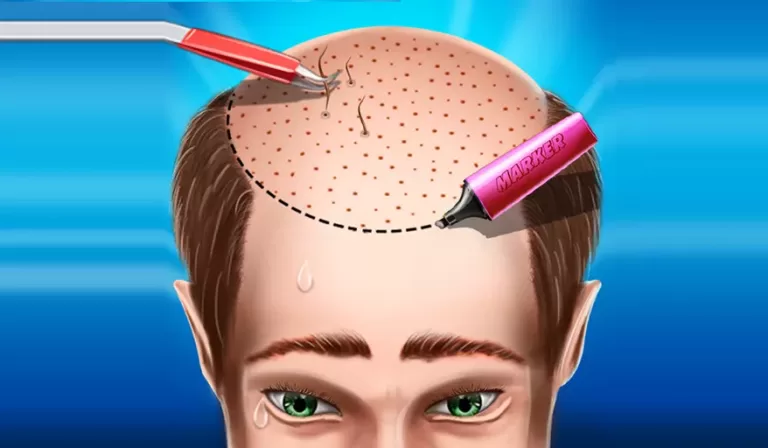 Hair Transplant, Trend Health