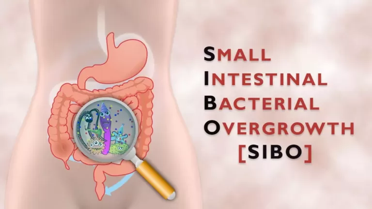 What Exactly is SIBO?, Trend Health