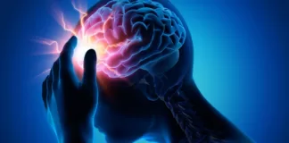 What to Expect After a Stroke?, Trend Health