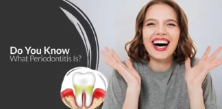 What is Periodontitis?, Trend Health