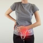 Causes of Pelvic Pain, Trend Health