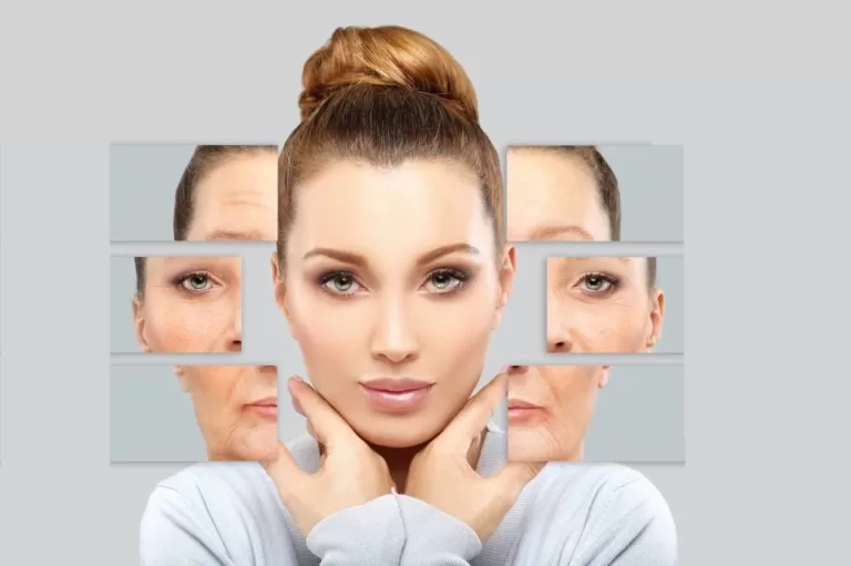 Should You Start Botox® Sessions?