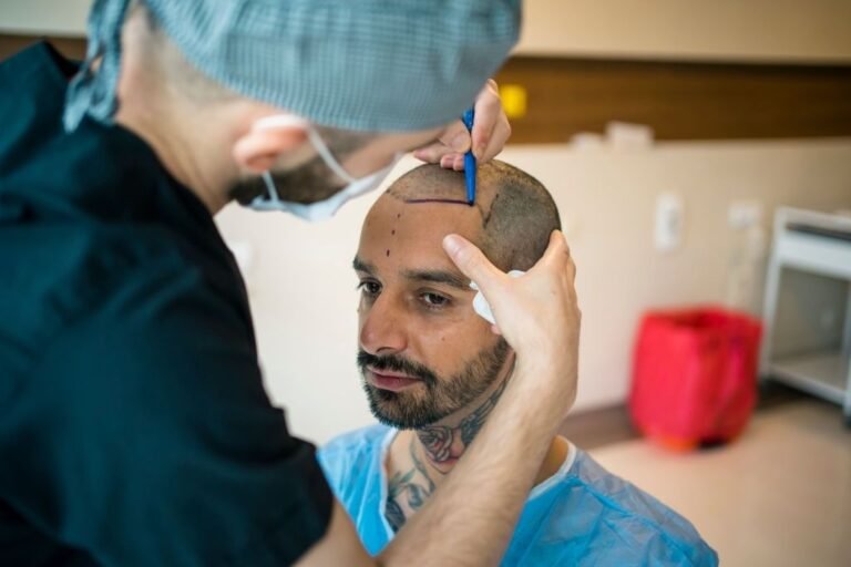 FUE Hair Transplantation, Trend Health