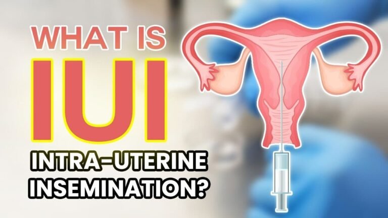 IUI Treatment
