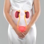 Bladder Cancer