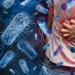 What is Cholera
