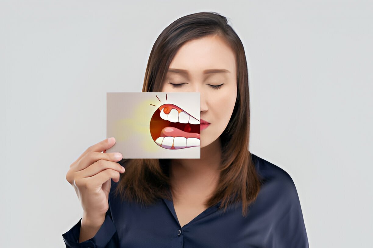 Periodontal Disease